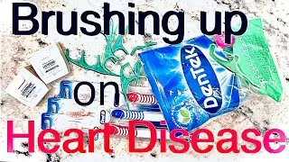 Dental Plaques and Heart Disease