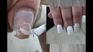 Переделки/Отслойки/Коррекция коротких ногтей/Царь-ноготь