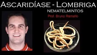 Verminoses - Ascaridíase ou Lombriga