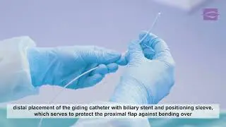 ERCP - Biliary Stent Placement using a Stent Placement Set - EndoFlex GmbH - EN