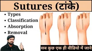 Sutures - Types, Classification, Removal and Absorption in Hindi | Nursing | Surgery | Medical | GNM