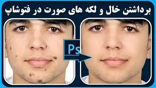 آموزش فتوشاپ | برداشتن خال و لکه های صورت در فتوشاپ | Remove Blemishes in Photoshop