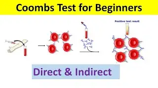 Coombs Test: Principle, Types, Procedure, Interpretation | Coombs test Direct and Indirect