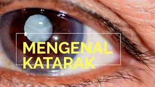 Gejala Katarak Dan Pengobatanya