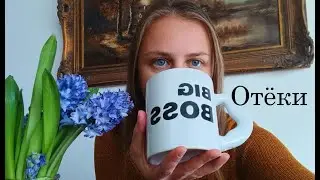 Отёки во время беременности. Гестоз? Или всё таки нет