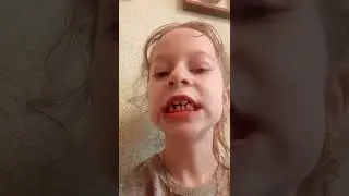 вырывание зуба дома ,ниткой