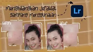 Menghilangkan jerawat/menghaluskan wajah MUDAH dengan aplikasi ini !!! Tutorial mia
