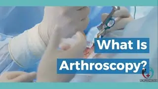 WHAT IS ARTHROSCOPY ? | ADVANTAGES OF ARTHROSCOPY || RJDS MEDIX