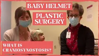Baby Helmet: Plastic Surgery Visit (What to look for before helmeting? "Craniosynostosis")