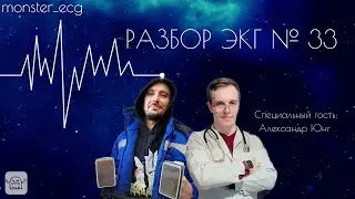 Разбор ЭКГ № 33