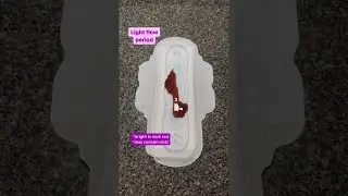 Is your period bleeding normal? Is it implantation bleeding or ovulation spotting?  