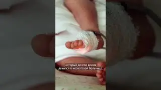 Как сотни детей в Кыргызстане случайно заразили ВИЧ