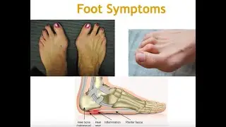 How Your Posture Creates Foot and Ankle PAIN - Do Shoes Help or Hinder Your Function?