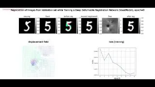 Deep Deformable Image Registration | CNN | UNet | NCC | MNIST | tensorflow | keras | python