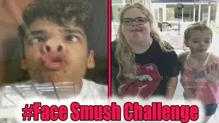 #Face Smush Challenge | Musical.ly Compilation