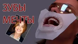 ВЛОГ НАТАЛИ РОШЕ: ВСЯ ПРАВДА О МОИХ ЗУБАХ! Визит к стоматологу