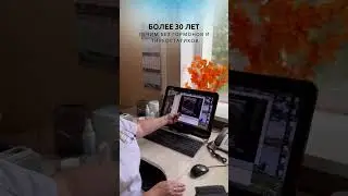 Лечим щитовидную железу #безтаблеток #гипотиреоз #рефлексотерапия