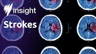 The road to recovering from a stroke