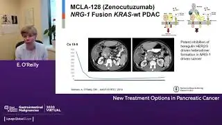 New Treatment Options in Pancreatic Cancer
