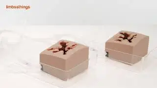 TruWound Demo