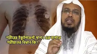 শরীরের ইকুইপমেন্ট স্থাপন এর ব্যপারে শরীয়তের বিধান কি?