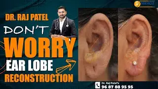कान का छेद बड़ा है तो घबराएं नहीं इस उपाय से करें छोटा | ear hole repair closing without surgery