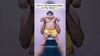The Most Unusual Babies In The World 🤯