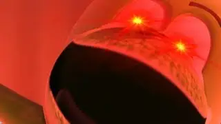 Gommy Butt 7 Preveiw