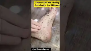 All Dirt & Tanning Remove From Feet In 5 Mnts Instantly ll#feetwhitening #skincare #pedicure #viral