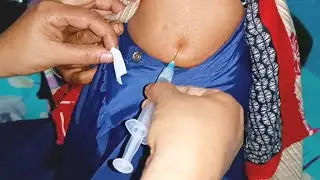 IM Intramuscular Arm injection Push. Ketorolac 30 mg Xerokit.  24 Ep 109 Anik Health Tips