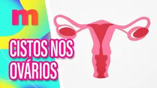 Saiba mais sobre CISTOS NOS OVÁRIOS - Mulheres (27/08/2024)