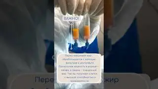 Липофилинг