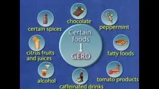 Factors that Contribute to GERD -- Dietary Factors