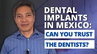 Can you trust Mexico Dentist for Dental Implants