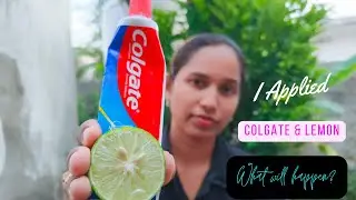 Glowing Skin Hack: Colgate Toothpaste & Lemon Face Mask Experiment! | Telugu Beauty Tips