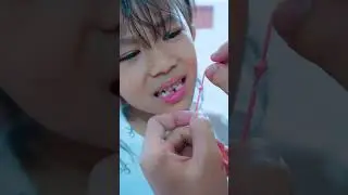 Papoy Pulled Aletha's Teeth Using a Rope 