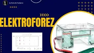 Elektroforez - ishlash mexanizmi va metodi