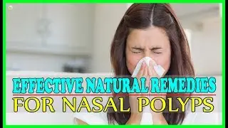 How To Cure Nasal Polyps Naturally At Home? - Effective Natural Remedies For Nasal Polyps