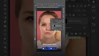 Remove acne in 