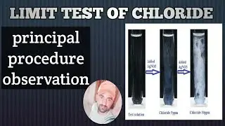 Limit Test Of Chloride
