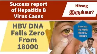 HBV DNA negative case details | HBSAG | Hepatitis B virus in Siddha medicine? week 2