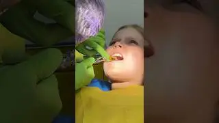REMOVING THE PLATE 🦷😍 