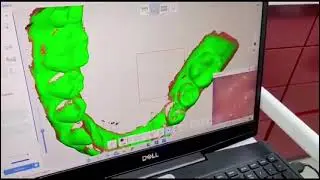 Stomatologia digitalizata, un nou concept!