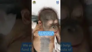 Didik The Baby Orangutan Has a BULLET removed from his body!