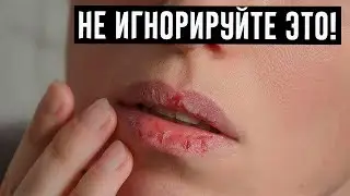 5 симптомов обезвоживания, которые игнорируются многими людьми!