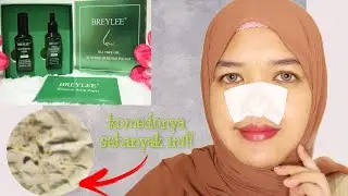 KOMEDO AUTO TERANGKAT SEMUA!! BREYLEE BLACKHEAD MASK DAN BREYLEE PORE MINIMIZER SERUM