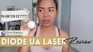 Diode Underarm Laser Hair Removal by Skin Station | HONEST REVIEW