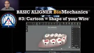 Monday Tip: Invisalign Clinchecks only dictate the Shape of the Aligner!