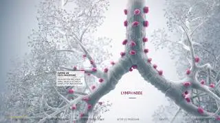 EBUS guide for patients: bronchoscopy technique for chest abnormalities