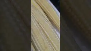 Buttered Baby corn, green beans, and garlic